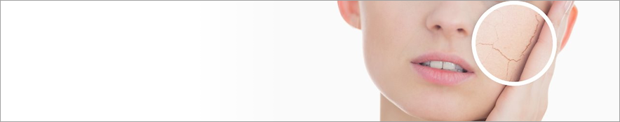 DEHYDRATED SKIN PRODUCTS