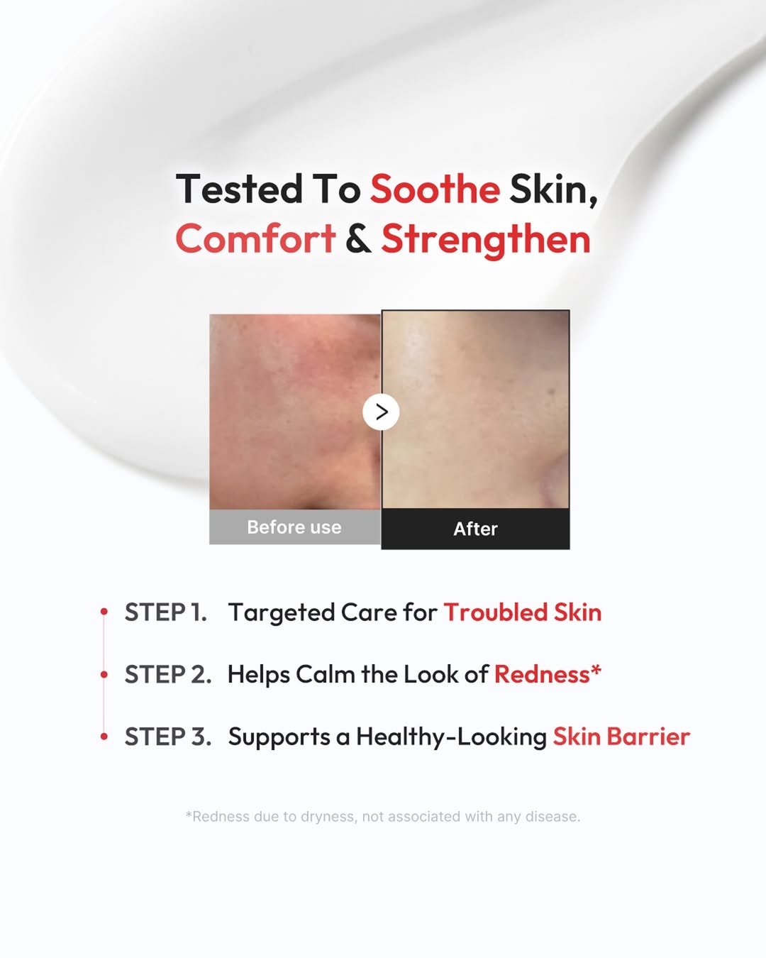 Hypochlorous 3H Relief Cream