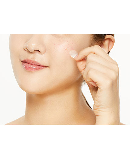 COSRX AC Collection Acne Patch BONIIK Best Korean Beauty Skincare Makeup in Australia