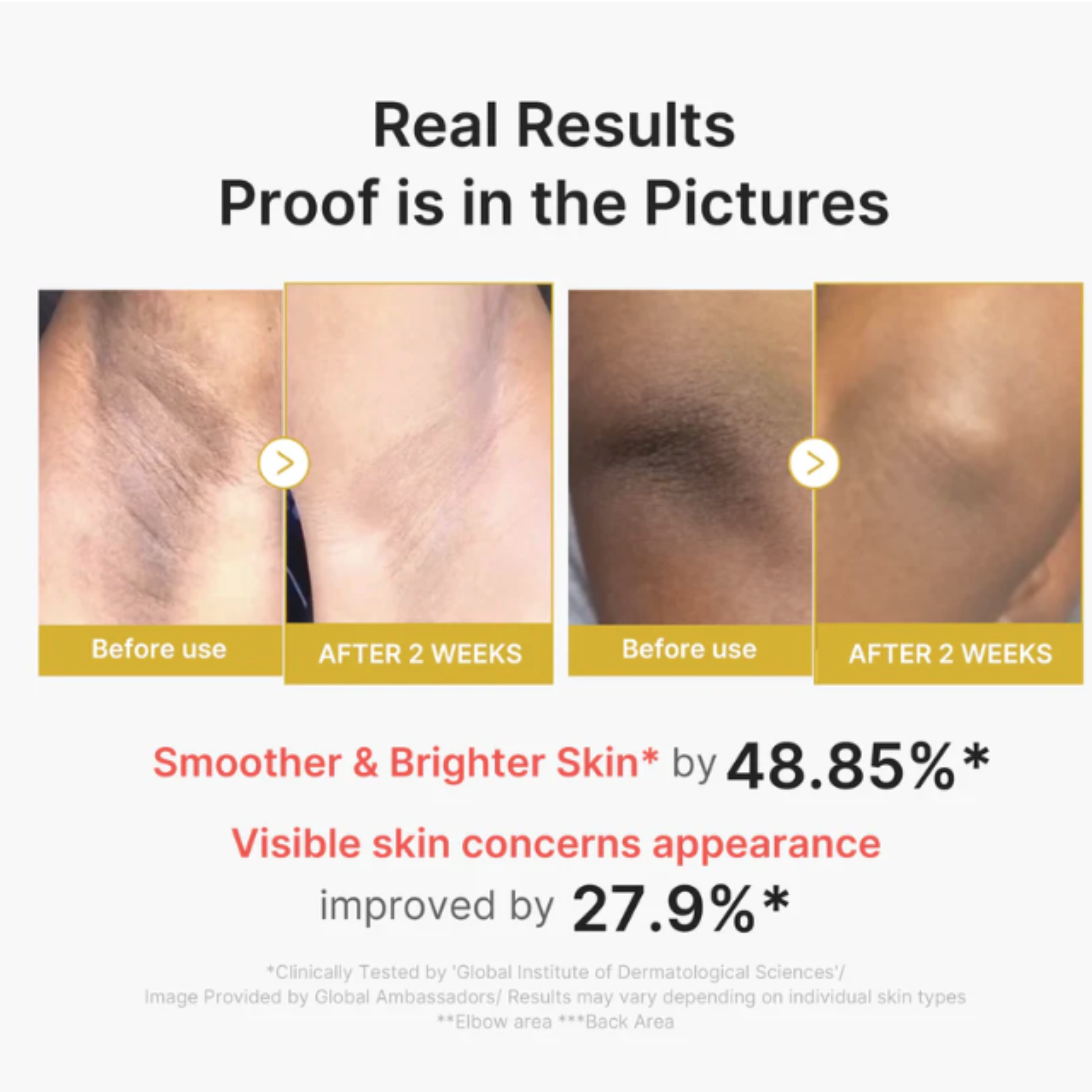 Kojic Acid Turmeric Body Peel Shot