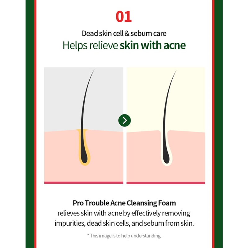 DERMATORY Acne Cleansing Foam For Acne-Prone Skin | BONIIK Australia